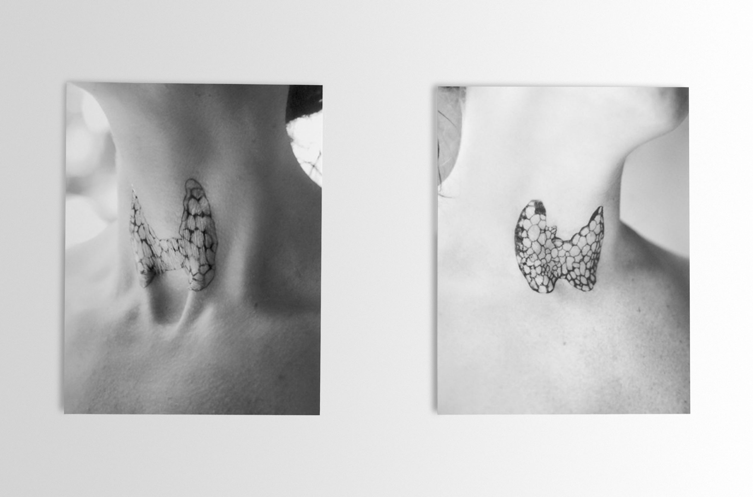 Photograph of a person's throat with a temporary tattoo of a thyroid over the location of the thyroid.